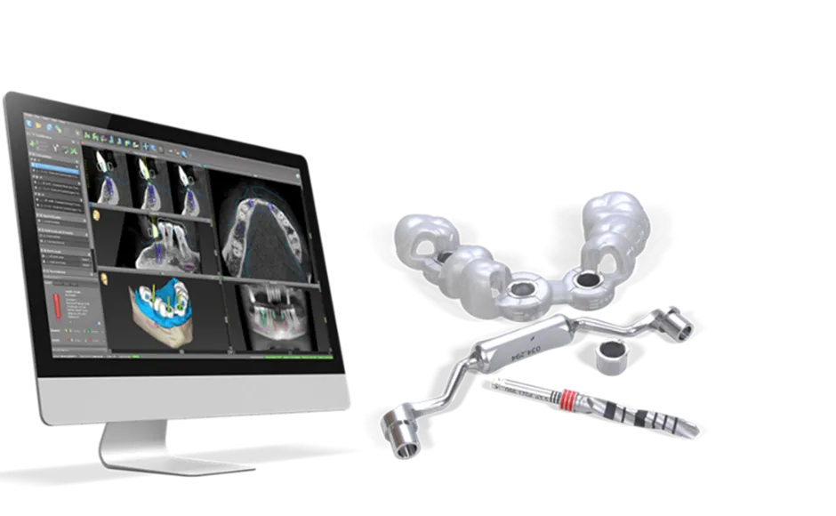 ストローマンのガイドを使用