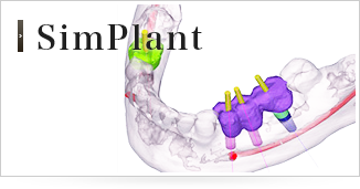 SimPlant