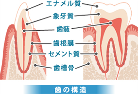 虫歯について