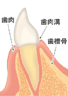 歯周病が進行すると